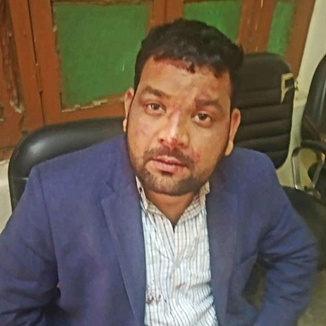 BHU: आपत्तिजनक हरकत पर असिस्टेंट प्रोफेसर को दौड़ा-दौड़ा कर पीटा