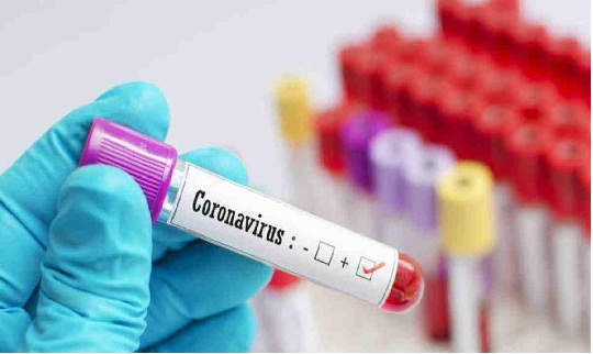 वाराणसी में कोरोना ने पकड़ी रफ्तार, 48 घंटे बाद 12 नए केस